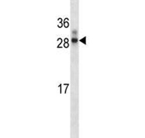 HOXA7 Antibody (N-Terminal Region)