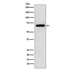 Western blot testing of human HeLa cell lysate with N-WASP antibody. Expected molecular weight: ~65