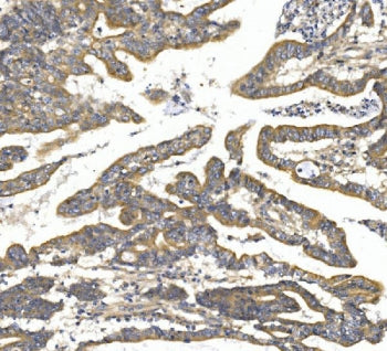 TTK Antibody