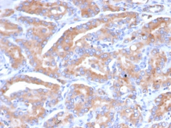 SI-CLP Antibody / CHID1 / Chitinase Domain Containing 1