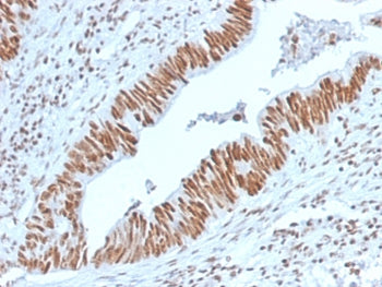 Nucleophosmin Antibody / NPM1