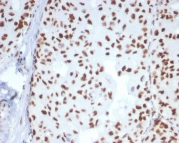 HSP70 Antibody / HSPA1B