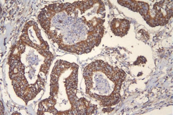 TFAM Antibody / mtTFA