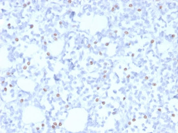 IHC staining of FFPE human breast with Estrogen Receptor beta 5 antibody (clone PPG5/25). HIER: boil