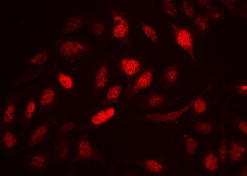 Immunofluorescent staining of FFPE human U-2 OS cells with Cyclin A2 antibody at 2ug/ml. HIER: steam