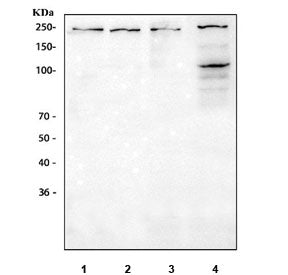 VEGFR1 Antibody
