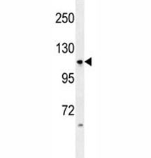 LGR5 Antibody (GPR49)