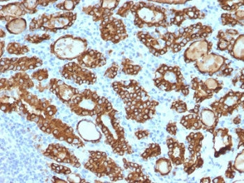 Thyroid Peroxidase Antibody