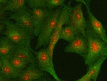 Immunofluorescent staining of FFPE human A549 cells with CENP-R antibody (red) and Beta Tubulin mAb
