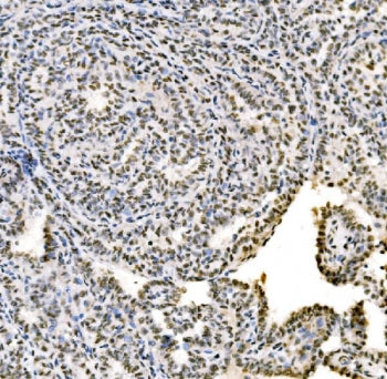 SSB Antibody / Lupus La protein