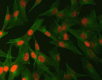 Abelson interactor 2 Antibody / ABI2
