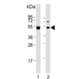 Lymphocyte Specific Protein 1 Antibody / LSP1