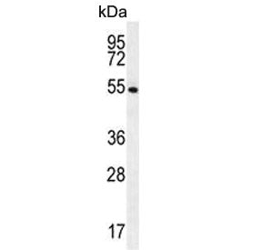 Glutathione Reductase Antibody / GSR