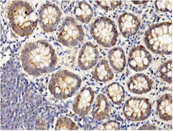 BubR1 Antibody / BUB1B