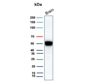 Western blot testing of human brain tissue lysate with GFAP antibody (clone GFAP/9421). Predicted mo