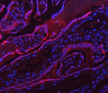 ATP5A1 Antibody / ATP5F1A / ATP synthase subunit alpha