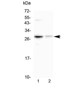 Oncostatin M Antibody / OSM