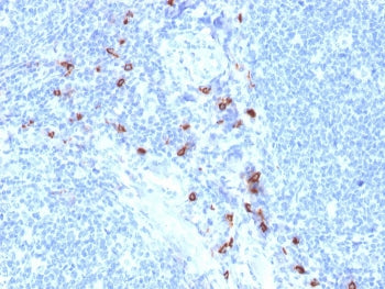 TPSAB1 Antibody / Mast Cell Tryptase
