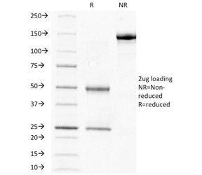 SDS-PAGE Analysis of Purified, BSA-Free HCG-beta Antibody (clone HCGb/211). Confirmation of Integrit