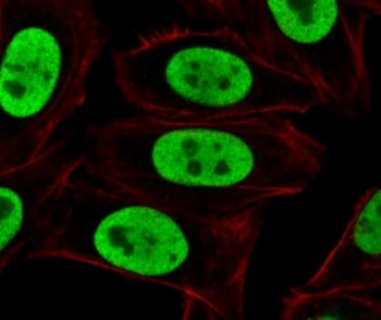 Ku70 + Ku80 Antibody