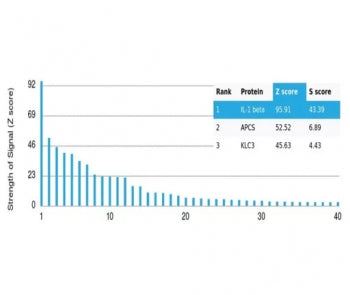IL-2 Antibody