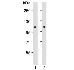 HK1 Antibody / Hexokinase 1