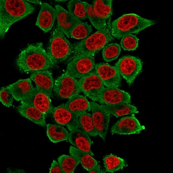 Alpha Actin Antibody / ACTA2 (smooth muscle)