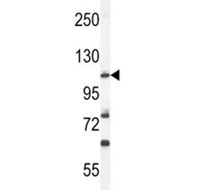 HIF1A Antibody (HIF-1 alpha)
