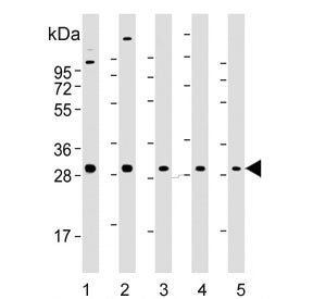 RAB23 Antibody