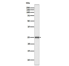 PGP9.5 / UchL1 Antibody