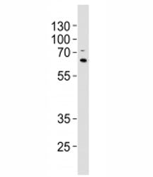 Western blot analysis of lysate from A549 cell line using p62 antibody at 1:1000. Observed molecular