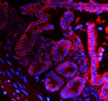 Epcam Antibody