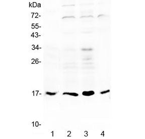Western blot testing of 1) rat stomach, 2) human COLO320, 3) human HeLa and 4) human SGC-7901 lysate