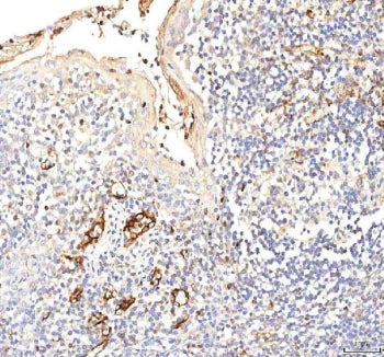 IHC staining of FFPE human tonsil tissue with Plakophilin 2 antibody. HIER: boil tissue sections in