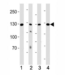 ROR1 Antibody