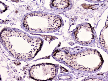 RAD51 Antibody