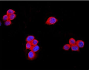 TRPM7 Antibody