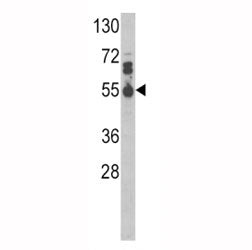 IL17RB Antibody