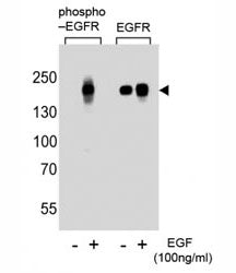 EGFR Antibody (phospho-S768)