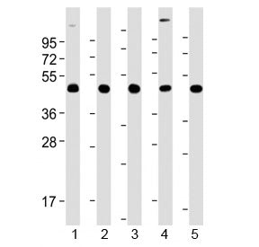 Western blot testing of human 1) brain, 2) K562, 3) Jurkat, 4) HepG2 and 5) A431 lysate with TSG101