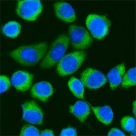 Immunofluorescent staining of FFPE human SiHa cells with DDX3 antibody (green) and DAPI nuclear stai