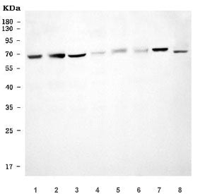 USP22 Antibody / Ubiquitin carboxyl-terminal hydrolase 22