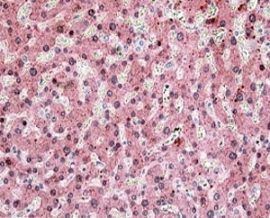 ITIH4 Antibody