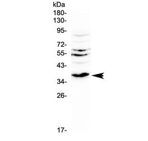 I12 p40 / Il-12b Antibody