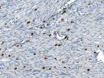 CD30 Antibody