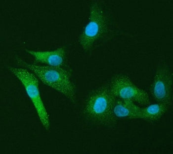 Leukocyte elastase inhibitor Antibody / LEI / SERPINB1 / PI-2