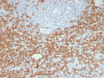 IHC staining of FFPE human tonsil tissue with recombinant CD5 antibody (clone C5/8117R). HIER: boil