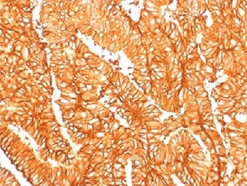 EpCAM Antibody