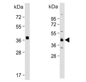 OTU1 Antibody / YOD1 / DUBA-8