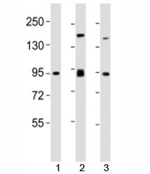 Western blot testing of SUZ12 antibody at 1:2000 dilution. Lane 1: mouse spleen lysate; 2: F9 lysate